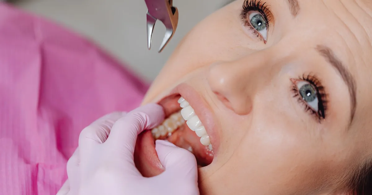 Tooth Extraction in Indirapuram: Pain, Recovery and What to Expect