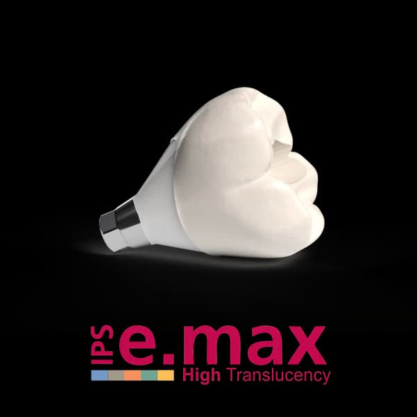 E-Max Crown and Implant Prosthesis in Indirapuram treatment at Kosmoss Dental Indirapuram