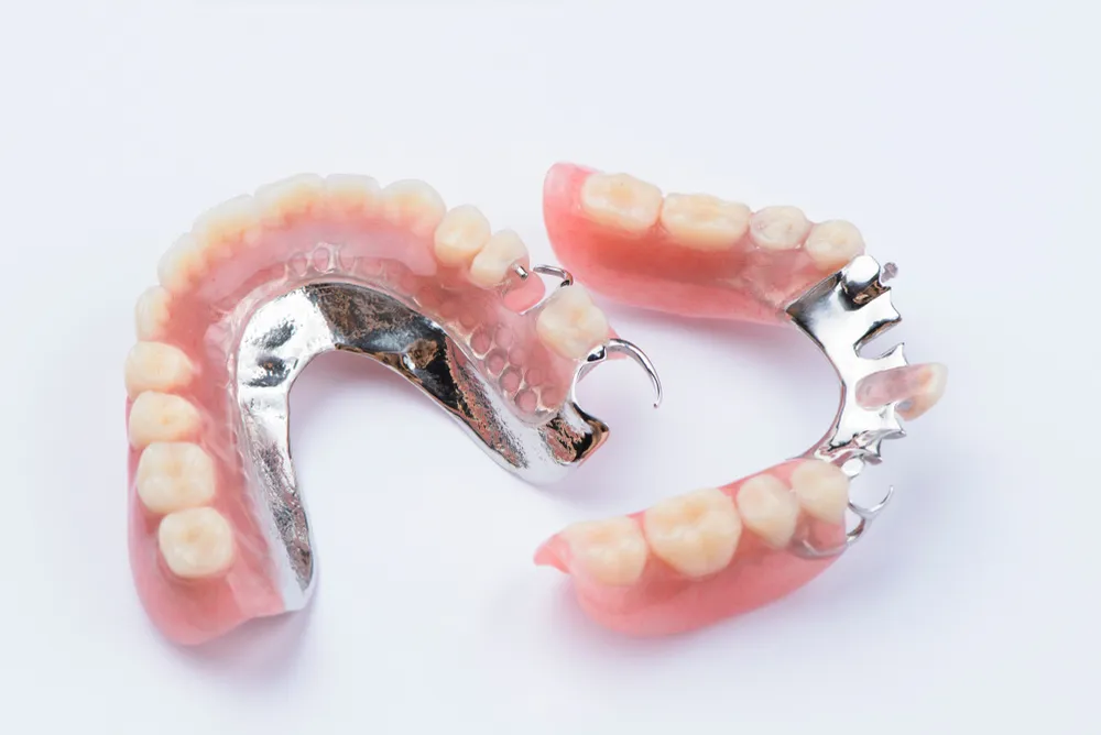 Best Metal-Based Complete Denture in Indirapuram treatment at Kosmoss Dental Indirapuram