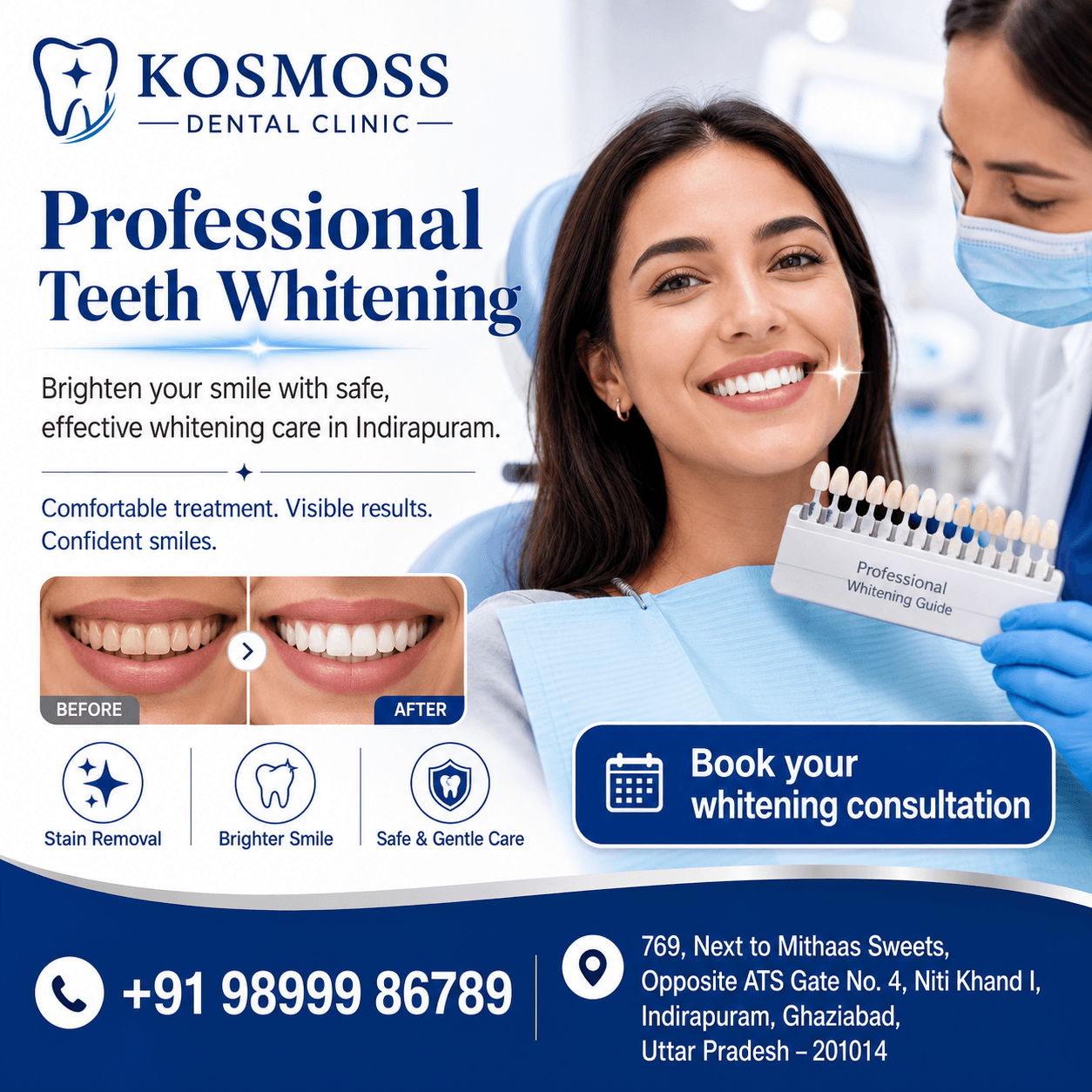 Teeth Whitening in Indirapuram treatment at Kosmoss Dental Indirapuram