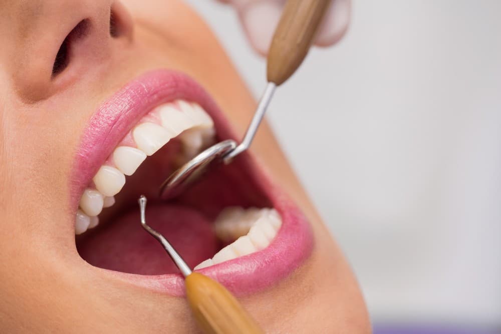 Teeth Cleaning Cost in India: Price, Process, Benefits