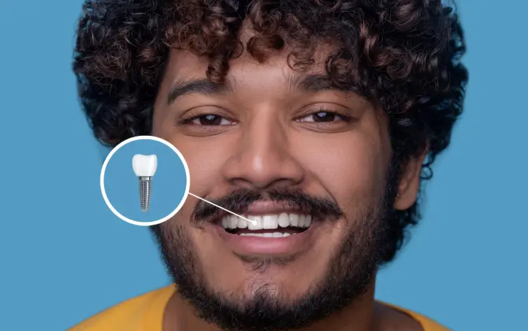 Dental Implant in Indirapuram