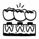Metal Dental Bridge in Indirapuram