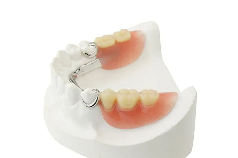 Best Removable Partial Denture (RPD) in Indirapuram treatment at Kosmoss Dental Indirapuram