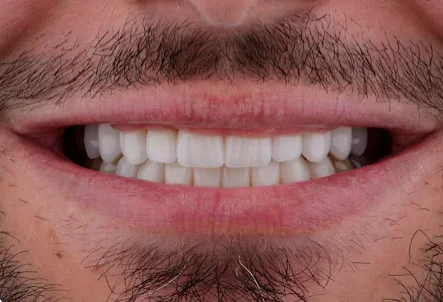 After dental treatment - improved patient smile